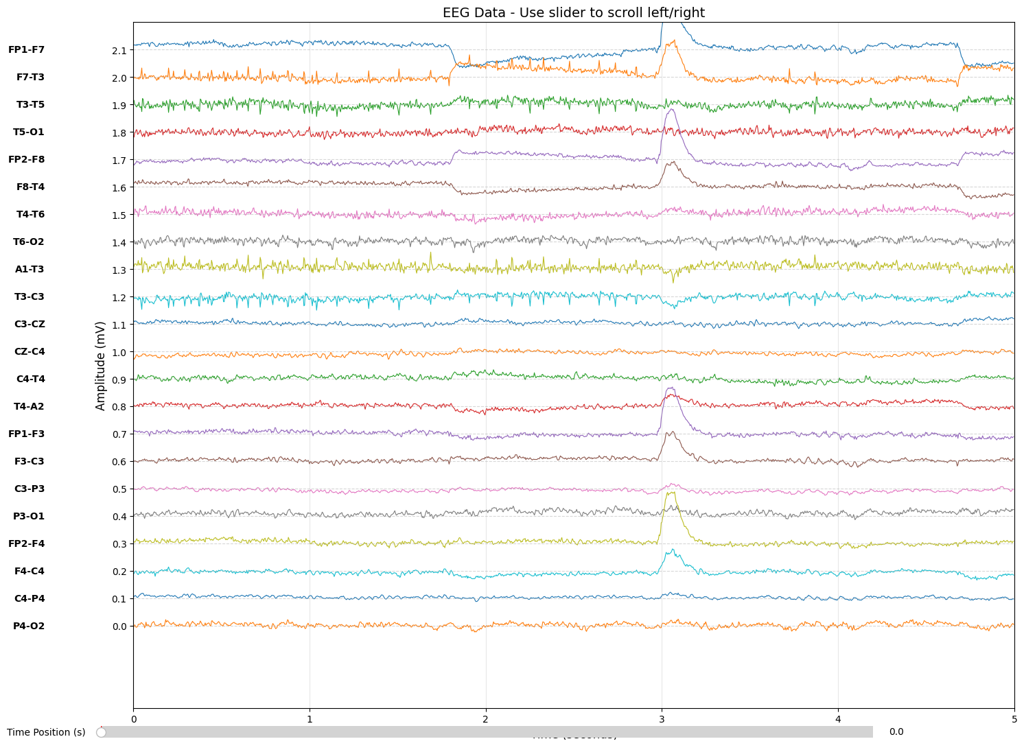 EEG visualization after bipolar montage transformation
