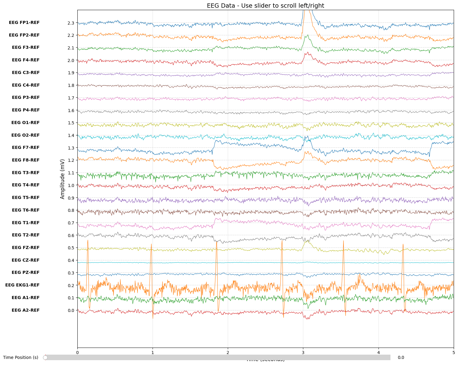 EEG visualization without montage transformation showing raw referential data